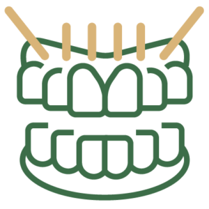Icon of teeth for zygomatic implants